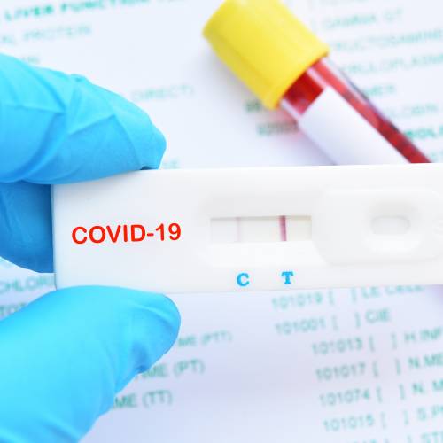 BCC Coronavirus Business Impact Tracker: More than 70 per cent of firms surveyed have furloughed staff as scheme goes live